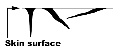 Cutaneous fold angle